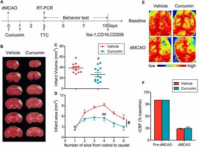 Curcumin Protects against Ischemic Stroke by Titrating Microglia/Macrophage Polarization